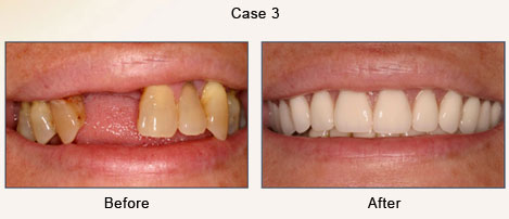 Case 3 – Cosmetic Treatment